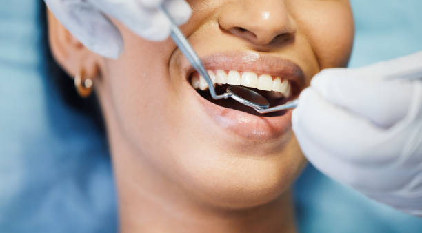 Best Chipped Tooth Repair Near Me  in Coram, NY