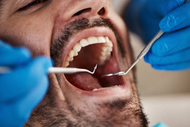 Best Dentist for Tooth Abscess  in Coram, NY